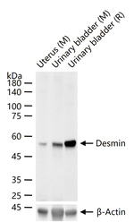 Desmin Antibody in Western Blot (WB)