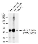 Acetyl-alpha Tubulin (Lys40) Monoclonal Antibody (6B5)