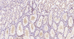 Galectin 3 Antibody in Immunohistochemistry (Paraffin) (IHC (P))