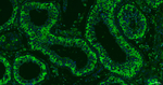 Galectin 3 Antibody in Immunohistochemistry (Paraffin) (IHC (P))