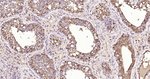 Galectin 3 Antibody in Immunohistochemistry (Paraffin) (IHC (P))
