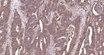 Galectin 3 Antibody in Immunohistochemistry (Paraffin) (IHC (P))