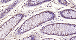 Galectin 3 Antibody in Immunohistochemistry (Paraffin) (IHC (P))