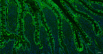 Galectin 3 Antibody in Immunohistochemistry (Paraffin) (IHC (P))