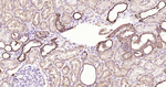 Galectin 3 Antibody in Immunohistochemistry (Paraffin) (IHC (P))