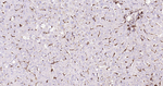 Galectin 3 Antibody in Immunohistochemistry (Paraffin) (IHC (P))