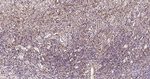 Galectin 3 Antibody in Immunohistochemistry (Paraffin) (IHC (P))
