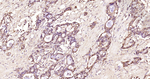 Galectin 3 Antibody in Immunohistochemistry (Paraffin) (IHC (P))