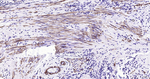 ACTA1 Monoclonal Antibody (3E9)