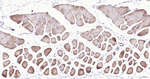 ACTA1 Antibody in Immunohistochemistry (Paraffin) (IHC (P))