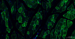 ACTA1 Antibody in Immunohistochemistry (Paraffin) (IHC (P))