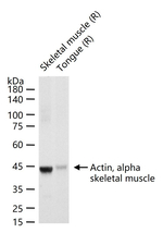 ACTA1 Antibody in Western Blot (WB)