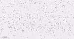Phospho-STAT3 (Tyr705) Antibody in Immunohistochemistry (Paraffin) (IHC (P))