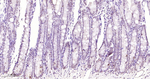 Phospho-STAT3 (Tyr705) Antibody in Immunohistochemistry (Paraffin) (IHC (P))