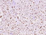 Phospho-STAT3 (Tyr705) Monoclonal Antibody (3F10)