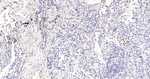 Phospho-STAT3 (Tyr705) Antibody in Immunohistochemistry (Paraffin) (IHC (P))