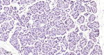 Phospho-STAT3 (Tyr705) Antibody in Immunohistochemistry (Paraffin) (IHC (P))