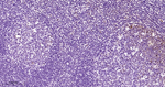 Phospho-STAT3 (Tyr705) Antibody in Immunohistochemistry (Paraffin) (IHC (P))