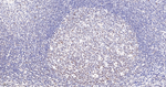 Phospho-STAT3 (Tyr705) Antibody in Immunohistochemistry (Paraffin) (IHC (P))