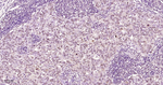 Phospho-STAT3 (Tyr705) Antibody in Immunohistochemistry (Paraffin) (IHC (P))