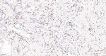 Phospho-STAT3 (Tyr705) Antibody in Immunohistochemistry (Paraffin) (IHC (P))