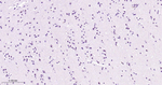 Phospho-STAT3 (Tyr705) Antibody in Immunohistochemistry (Paraffin) (IHC (P))