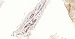 Phospho-STAT3 (Tyr705) Antibody in Immunohistochemistry (Paraffin) (IHC (P))