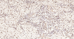 Phospho-STAT3 (Tyr705) Antibody in Immunohistochemistry (Paraffin) (IHC (P))