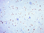 Phospho-STAT3 (Tyr705) Antibody in Immunohistochemistry (Paraffin) (IHC (P))