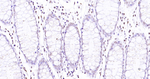 ERK1 Antibody in Immunohistochemistry (Paraffin) (IHC (P))