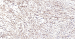 Collagen II Monoclonal Antibody (9H12)