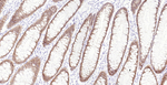 Villin Antibody in Immunohistochemistry (Paraffin) (IHC (P))