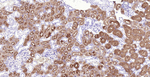 Villin Antibody in Immunohistochemistry (Paraffin) (IHC (P))