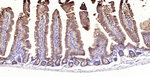 Villin Antibody in Immunohistochemistry (Paraffin) (IHC (P))