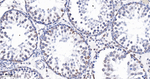 Lamin B1 Antibody in Immunohistochemistry (Paraffin) (IHC (P))
