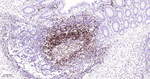 CD79a Antibody in Immunohistochemistry (Paraffin) (IHC (P))