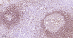 CD79a Antibody in Immunohistochemistry (Paraffin) (IHC (P))