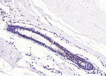 Calprotectin Monoclonal Antibody (10D11)