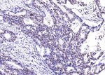 Calprotectin Antibody in Immunohistochemistry (Paraffin) (IHC (P))