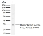 Calprotectin Antibody in Western Blot (WB)