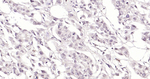 SOCS1 Antibody in Immunohistochemistry (Paraffin) (IHC (P))