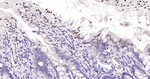 SOCS1 Recombinant Rabbit Monoclonal Antibody (4B2)