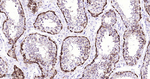 MAGEC1 Monoclonal Antibody (1F2)