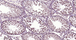 FGF2 Antibody in Immunohistochemistry (Paraffin) (IHC (P))