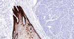 Cytokeratin 15 Monoclonal Antibody (2H8)