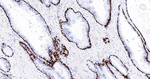 Cytokeratin 15 Antibody in Immunohistochemistry (Paraffin) (IHC (P))