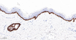 Cytokeratin 15 Antibody in Immunohistochemistry (Paraffin) (IHC (P))