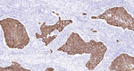 Cytokeratin 15 Antibody in Immunohistochemistry (Paraffin) (IHC (P))