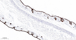 Cytokeratin 15 Antibody in Immunohistochemistry (Paraffin) (IHC (P))