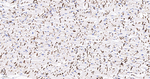 N-cadherin Antibody in Immunohistochemistry (Paraffin) (IHC (P))